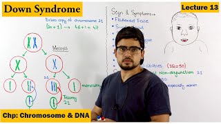 Downs Syndrome  A Genetic Disorder  Lecture 13 [upl. by Frederich]