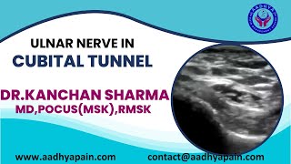 Ultrasound of the Ulnar Nerve in the Cubital Tunnel and its Dynamic Examination [upl. by Aynotak736]