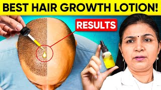 Best Hair Growth Lotion and Hair Loss Treatment for Men amp Women [upl. by Rubinstein391]