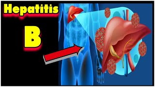 Hepatitis B in 5 Minuten verstehen [upl. by Hisbe737]