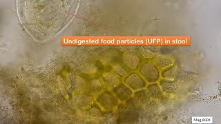 Undigested food particles in faeces Microscopy at 400X and 800X [upl. by Novets842]