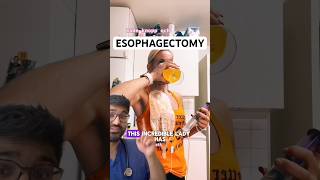 DOCTOR REACTS to ESOPHAGECTOMY and ESOPHAGOSTOMY [upl. by Gelya496]