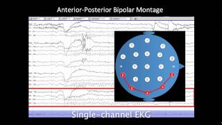 Introduction to EEG [upl. by Eleonore]