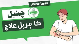 Psoriasis Causes amp Herbal Treatment  چنبل کی وجوہات اور ہربل علاج  howtotreatpsoriasis [upl. by Allanson]