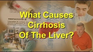 What Causes Cirrhosis Of The Liver [upl. by Savart]