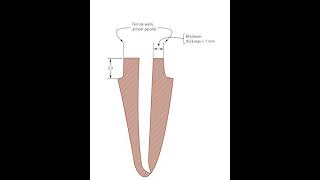 Ferrule effect Dr Mazen Doumani [upl. by Erdnassac752]