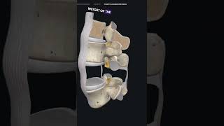 Ligamentum Falavum Hypertrophy [upl. by Sualocin]