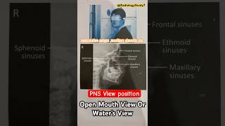 Para nasal sinus view PNS view  xray radiology shorts medical medicalimaging xrays xray [upl. by Aihseya578]