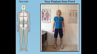 Postural Assessment Guide [upl. by Lianne]