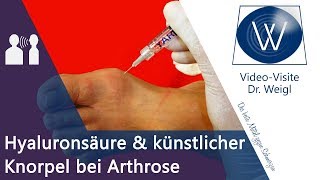 Helfen Hyaluronsäure amp Knorpel Transplantation bei Arthrose Arthrose Therapie  Arthrose heilen [upl. by Engel]