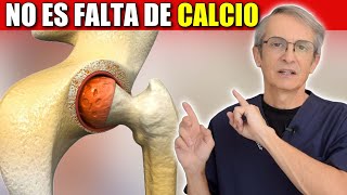 😳 La OSTEOPOROSIS 🦴 no es una DEFICIENCIA de CALCIO  Remedios Osteoporosis [upl. by Leeanne]