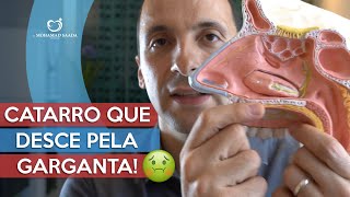 De onde vem o CATARRO que desce na GARGANTA e o do PEITO │ Médico Explica [upl. by Mortie]