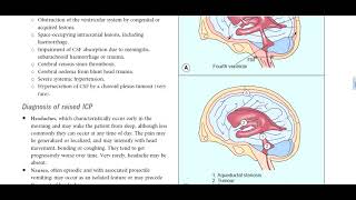 Kanski Clinical Ophthalmology Made Easy  neuroophthalmology 8 [upl. by Mattson]