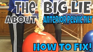 The BIG LIE About Anterior Pelvic Tilt How to Fix [upl. by Lednik]