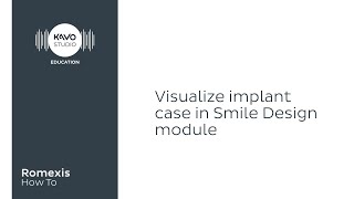 Romexis How To Visualise implant case with smile design [upl. by Adle270]