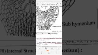 Practical Peziza Apothecium And Puccinia Vinita Singhal [upl. by Orag]