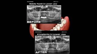 Proud to Share another example of a collaborative efforts to get best treatment result to r patients [upl. by Yrebmik233]