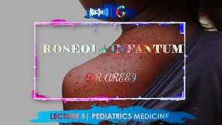 ROSEOLA INFANTUM  DrAREEJ  LECTURE 5 [upl. by Hcra232]