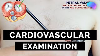 Cardiovascular Examination  OSCE Guide  UKMLA  CPSA [upl. by Vacuva961]