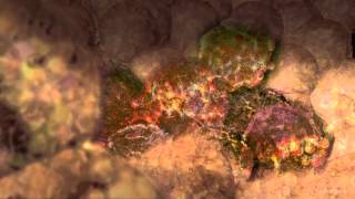 Cancer Cells Undergoing Mitosis [upl. by Jahn]