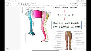 PATOFISIOLOGI NBS CASE 4 quotLBP ec HNPquot  ray [upl. by Menon]