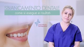 Sbiancamento dentale  come si esegue e risultati [upl. by Kerrie]