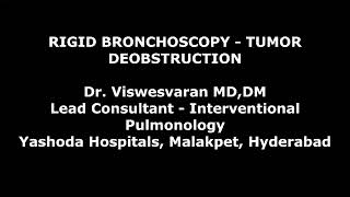 Rigid Bronchoscopic Tumor Debulking  Electrosurgical snaring  Cryoextraction [upl. by Laetitia]