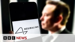 Elon Musk announces first Neuralink wireless brain chip implant in a human  BBC News [upl. by Ahsyle246]