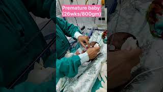 How to do sponging of premature baby training sessions shorts prematurebaby youtubeshorts [upl. by Asiaj]