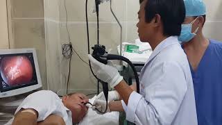 Transnasal Gastroscopy [upl. by Avir]