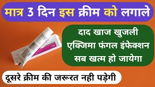 मात्र 1 क्रीम से दाद खाज खुजली 3 दिन में खत्म Best Ketoconazole Cream For Fungal Infection Problems [upl. by Liauqram]