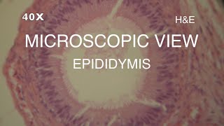 MICROSCOPIC VIEW  EPIDIDYMIS [upl. by Nitsu]