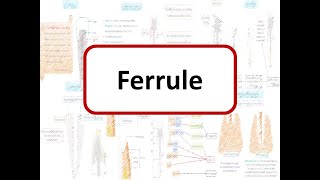 Ferrule effect Need for Ferrule Advantages Design amp Classification of Ferrule [upl. by Akinyt]