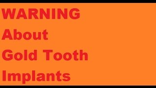 Gold Tooth Implant Secret Problems [upl. by Eelrebmyk]