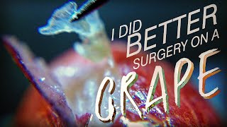 I Did BETTER Surgery on a Grape [upl. by Aiceila]