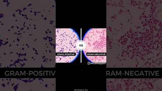 Gram stain  Gram stain procedure manual  medical shortvideo viralvideo microbiology mbbs [upl. by Nam666]