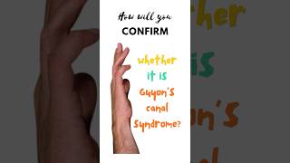 Confirmatory test for Guyon’s canal syndrome Froment’s test Ulnar tunnel syndrome shorts [upl. by Etac]