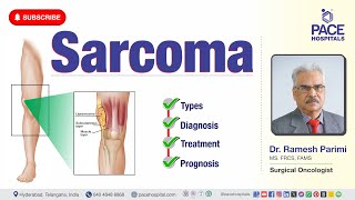 Sarcoma Cancer  Types Diagnosis Treatment amp Prognosis  sarcomatreatment [upl. by Kessler]