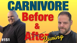 Carnivore Diet Before and after 151 [upl. by Eldwen]