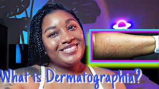 What is Dermatographia  Living with it  help ease it Dermatographism DermatographicUrticaria [upl. by Thomsen]