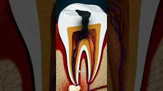 Why Grinding Your Teeth Is Bad 😱 [upl. by Ramberg119]