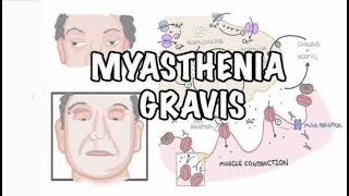 Myasthenia gravis History mrcpch Clinical [upl. by Theta]