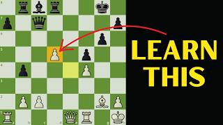 Stop Ignoring Your Pawns Win More Chess Games [upl. by Dell]