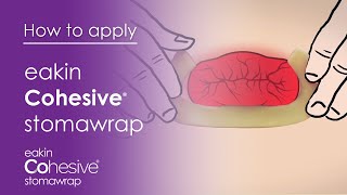 How to apply Cohesive StomaWrap™ [upl. by Pomona]