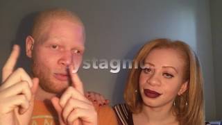 Albinism amp Nystagmus [upl. by Eiduam]