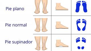 Fisioterapia y Osteopatía para la fascitis plantar [upl. by Lynette]