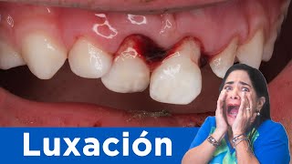 ⚠️ Luxación dental [upl. by Aric506]