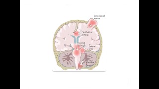 Understanding Kernohans Phenomenon  Central Nervous System  Internal Medicine [upl. by Moneta]