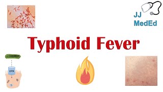 Typhoid Fever Pathogenesis vectors bacteria Symptoms Diagnosis Treatment Vaccine [upl. by Alphonsine]