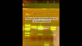 Gel Electrophoresis [upl. by Moshell]